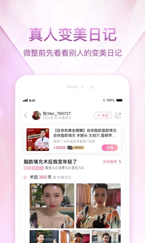 悦美app