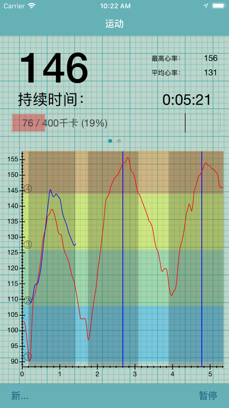 心率记录图app